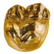 dental gold buyers las vegas